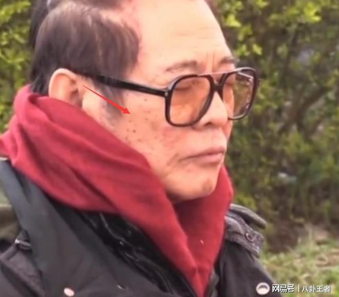 黑斑掉发严重老成80岁憔悴病容令人担忧尊龙凯时网站曝60岁李连杰近照！满脸(图1)