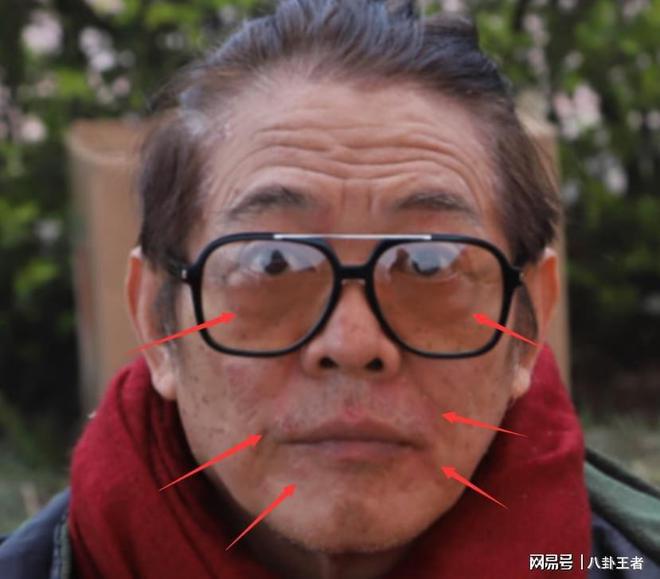黑斑掉发严重老成80岁憔悴病容令人担忧尊龙凯时网站曝60岁李连杰近照！满脸(图2)