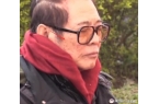 黑斑掉发严重老成80岁憔悴病容令人担忧尊